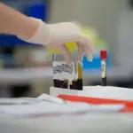 Koçiu : Njësinë Levizëse të Dhurimit të Gjakut do të jenë në gjithë Shqipërinë gjatë muajit Shkurt