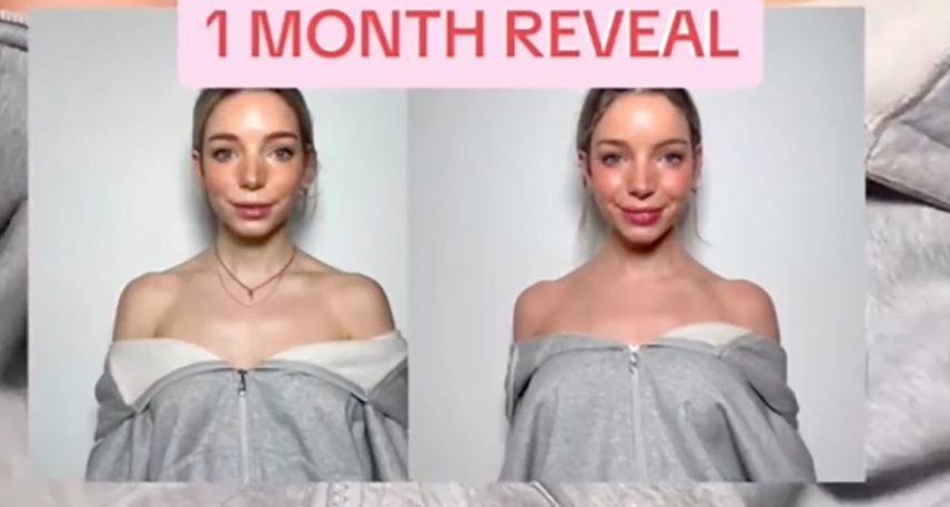 Çfarë është 'Barbie Botox', trendi më i fundit i bukurisë i TikTok?