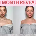 Çfarë është 'Barbie Botox', trendi më i fundit i bukurisë i TikTok?